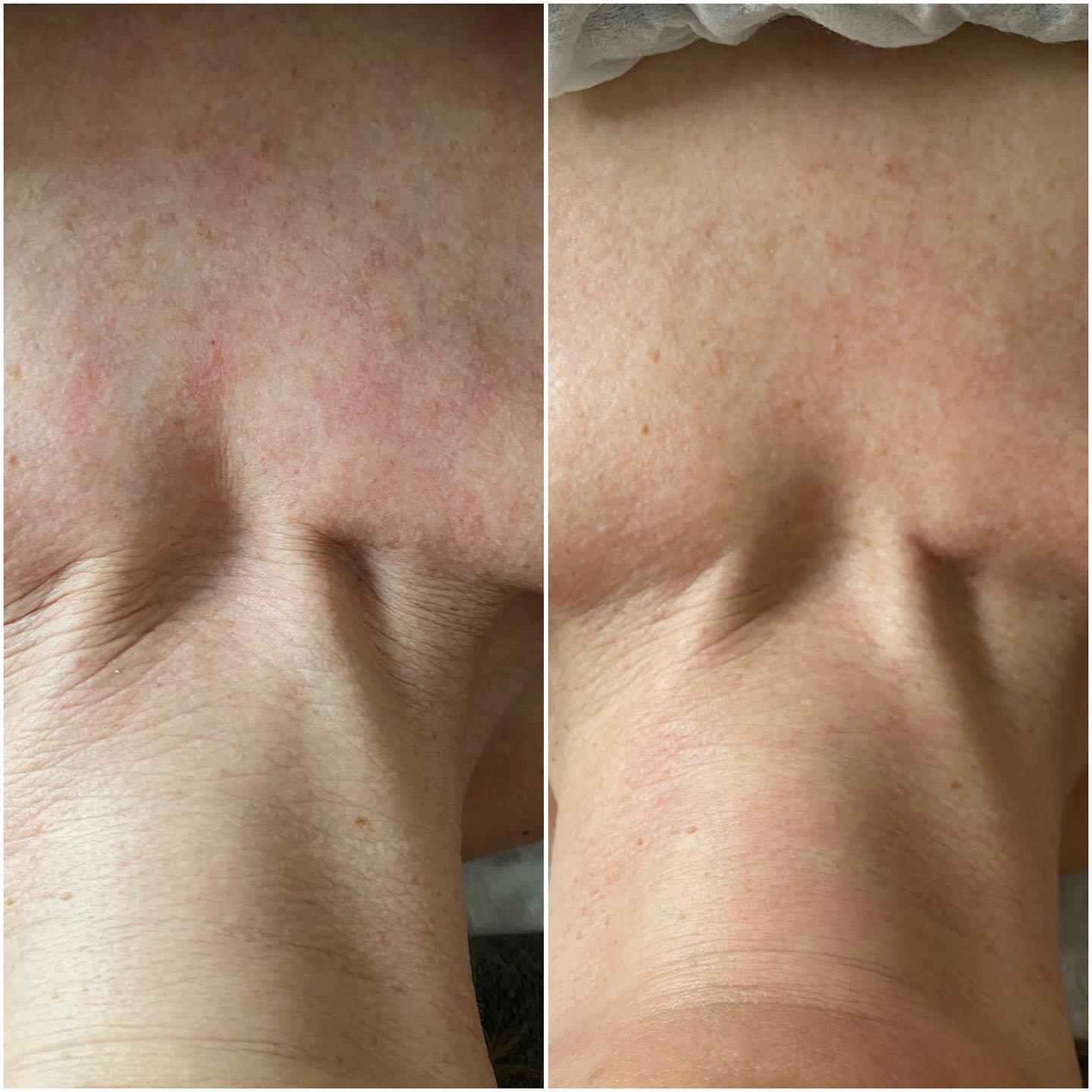 Organic Konjac Natural Neck & Decolté Mask