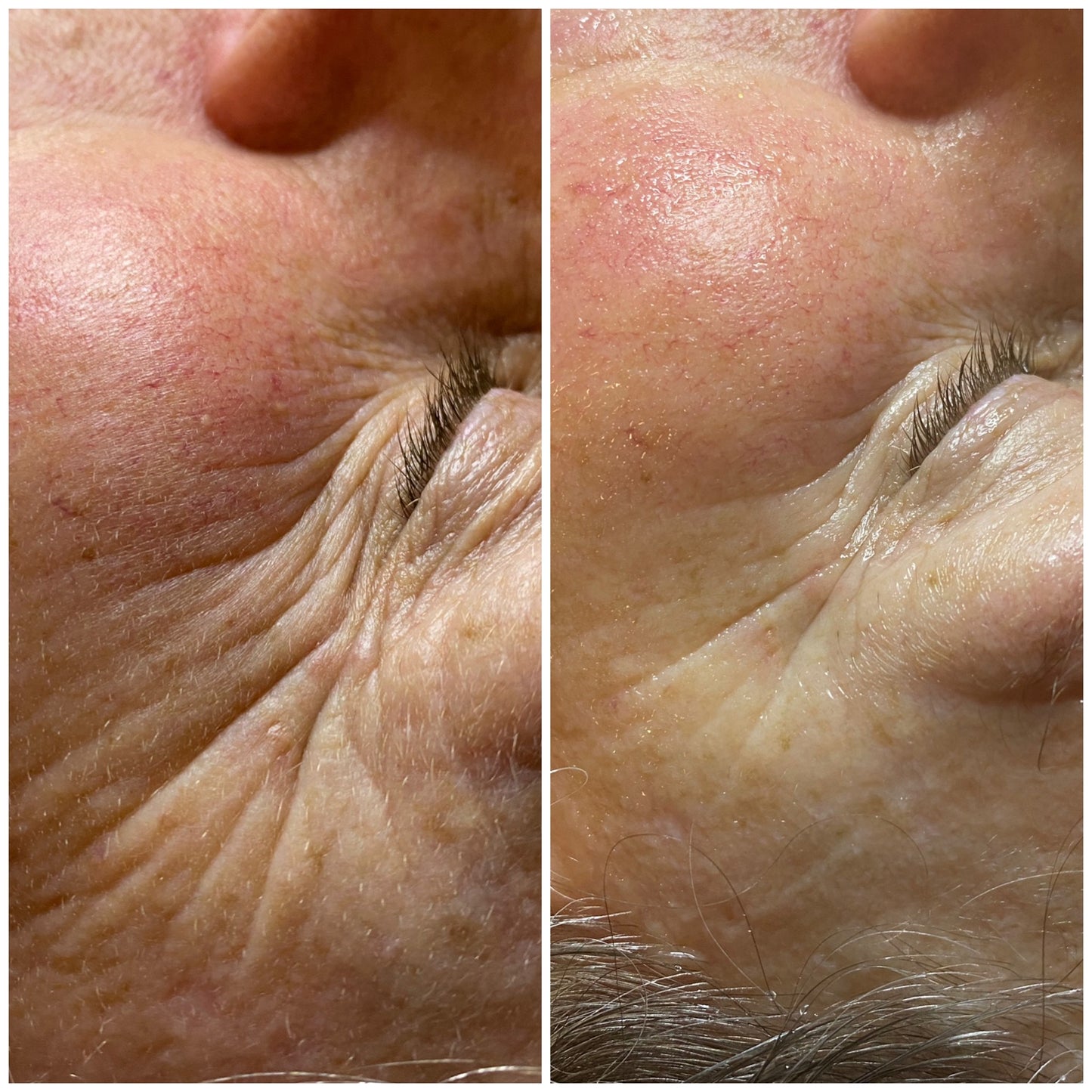 Organic Konjac Natural Eye Mask - 10 X 2 stk